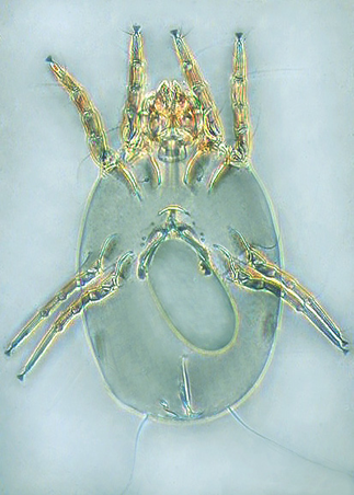 Female of Dermatophagoides farinae