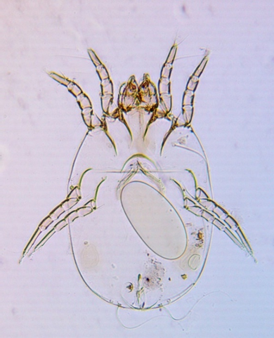 Female of Dermatophagoides pteronyssinus